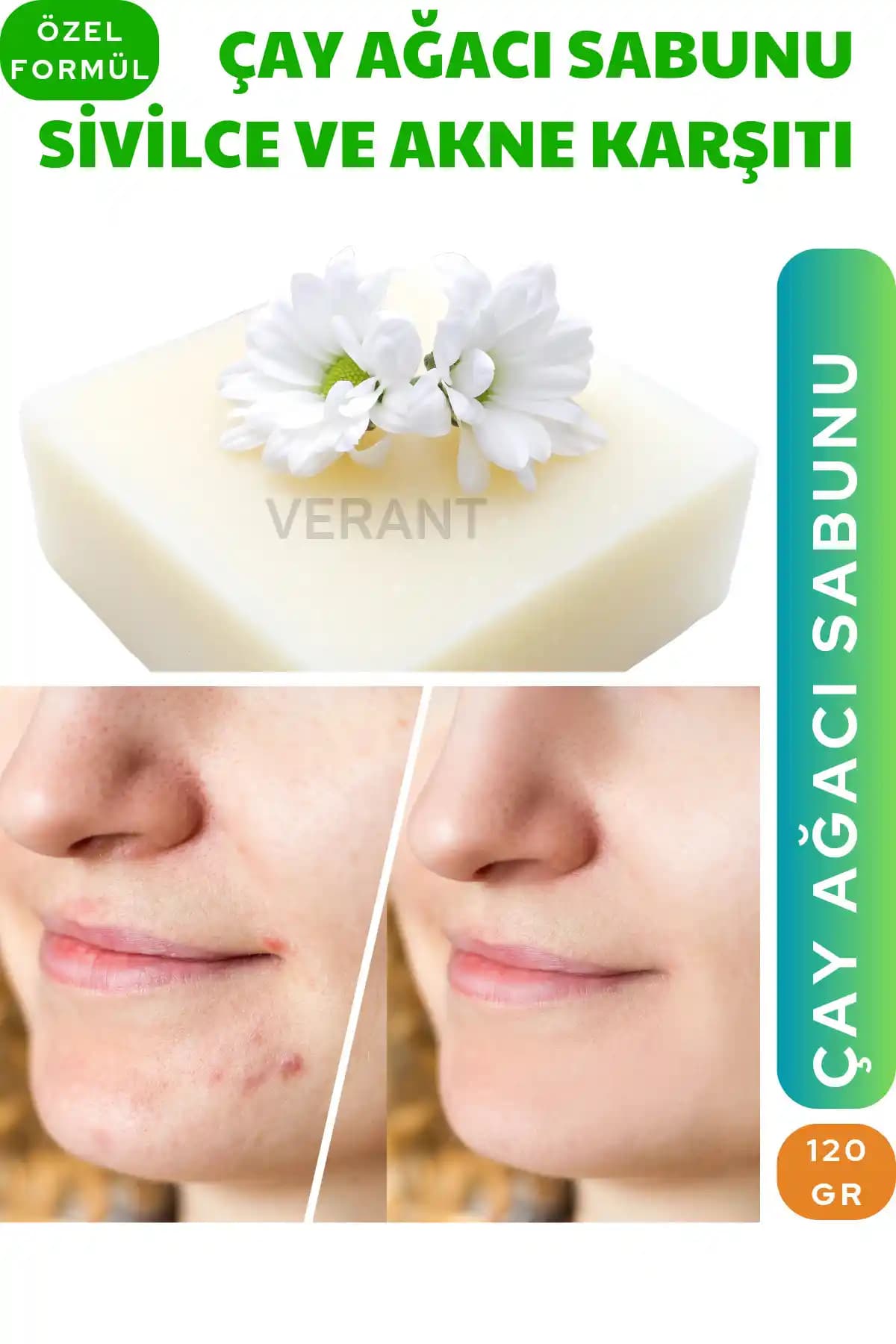 VERANT Çay Ağacı Sabunu ile Doğal ve Etkili Akne ve Sivilce Karşıtı Cilt Temizliği