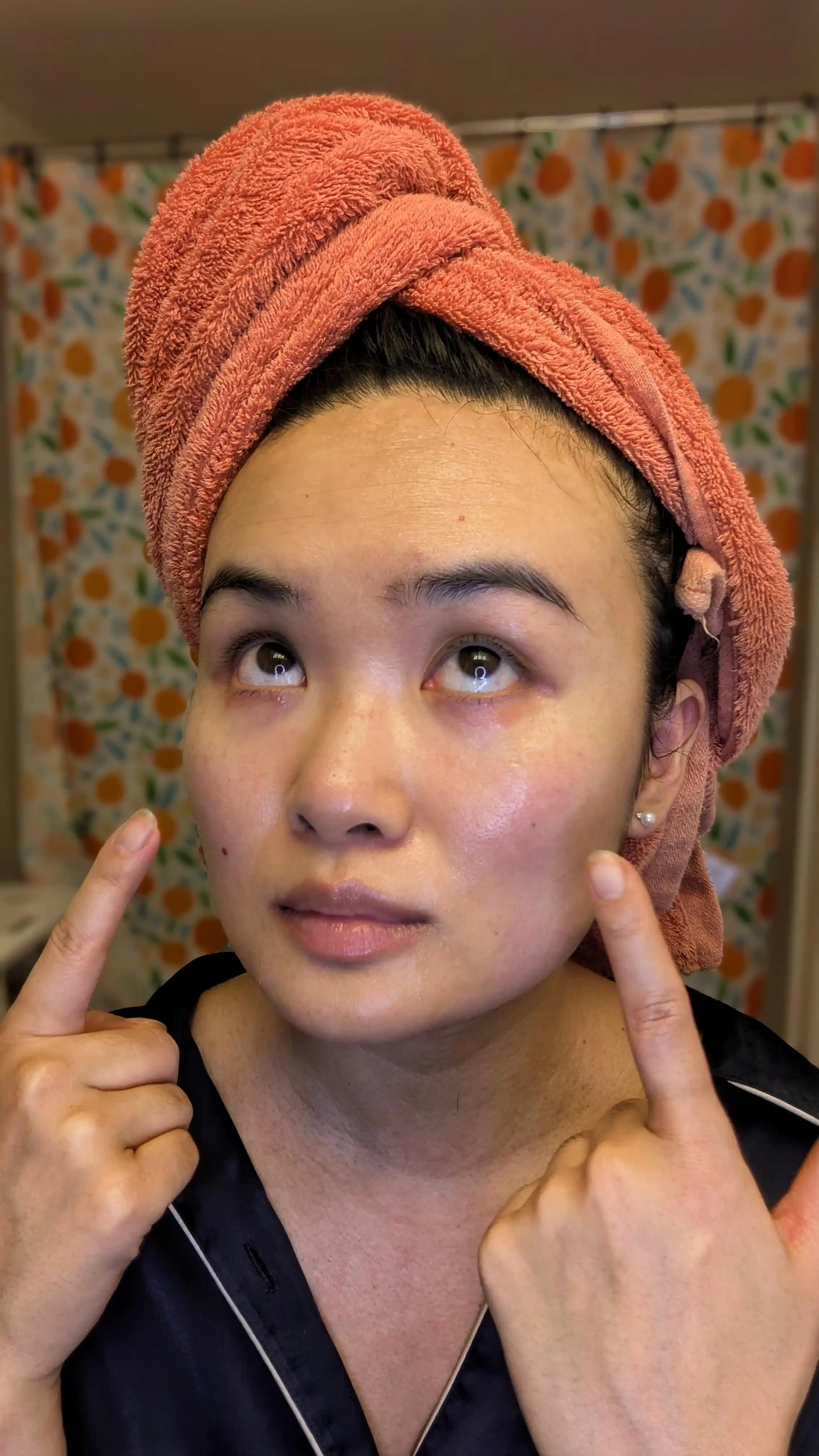 30'lu Yaşlarda Alt Göz Altı Egzaması: Nedenleri, Belirtileri ve Tedavi Yöntemleri