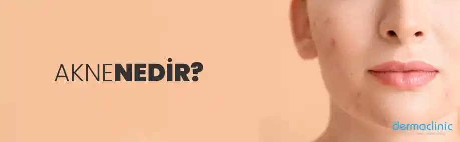 Aknenin Zihinsel, Sosyal ve Günlük Hayat Üzerindeki Çok Boyutlu Etkileri ve Mücadele Yöntemleri