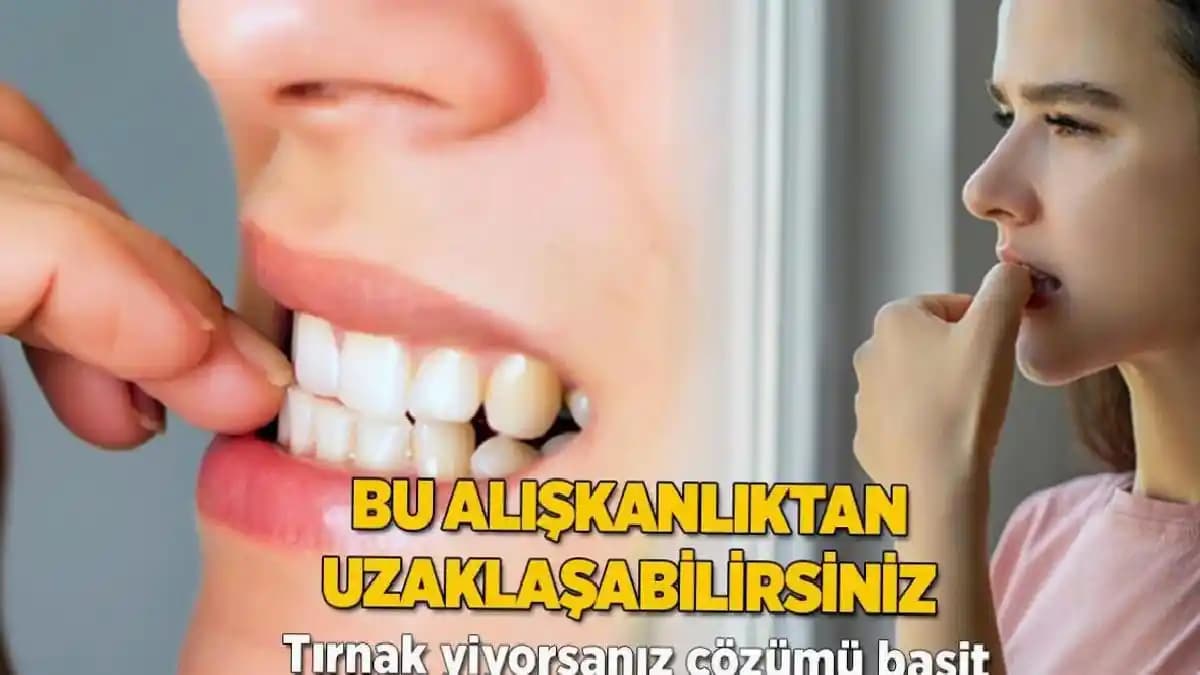 Tırnak Yeme Alışkanlığını Kontrol Altına Alma Yöntemleri ve Etkili Bakım Önerileri