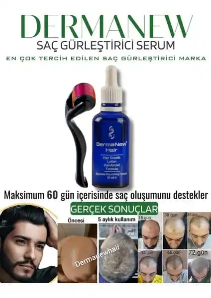 Dermanew Saç Losyonu ve Roller Seti Bitkisel Vegan İçeriklerle Saç Dökülmesini Destekler