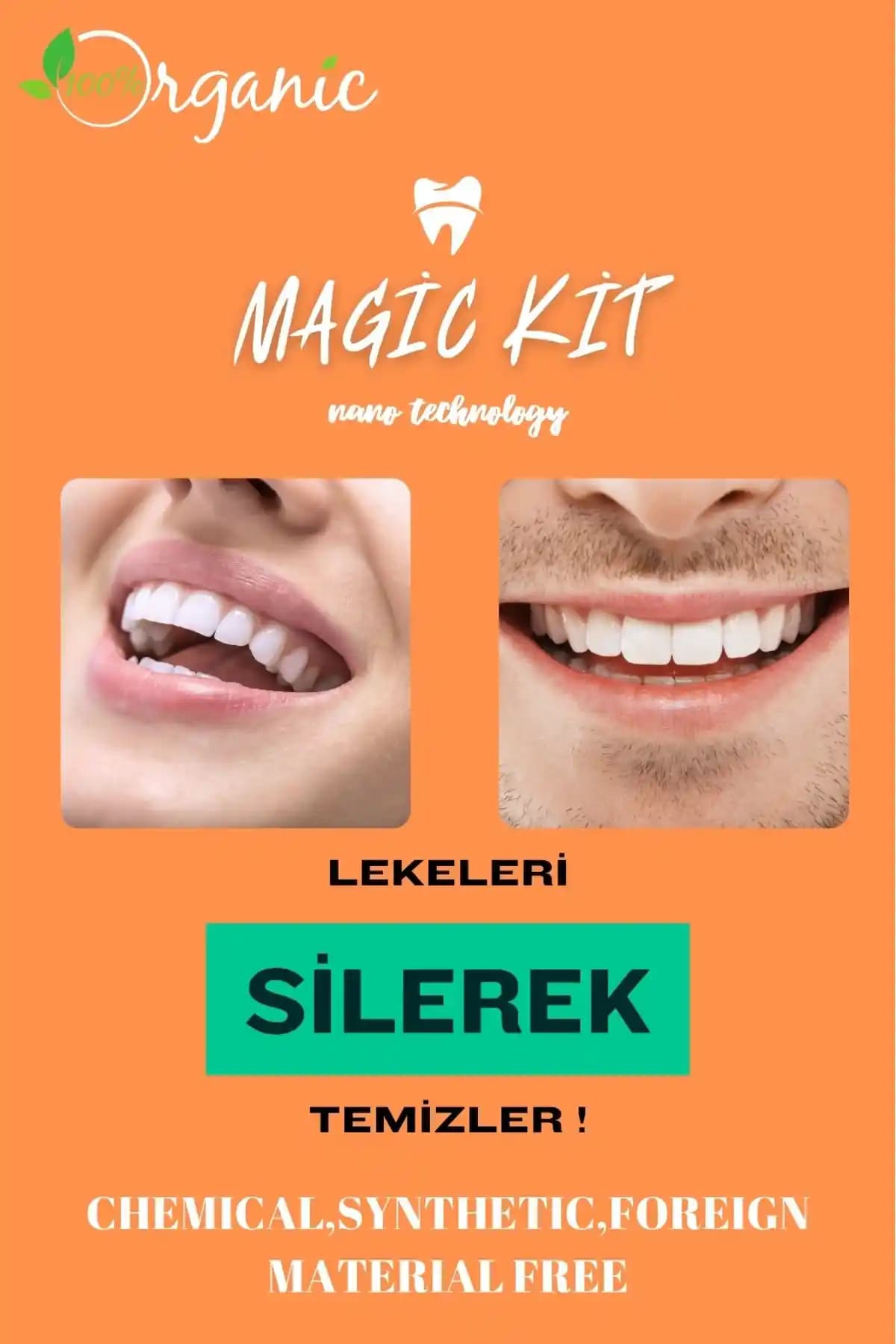 Magic Kit Diş Leke Silgisi ile doğal ve güvenli diş beyazlatma çözümü