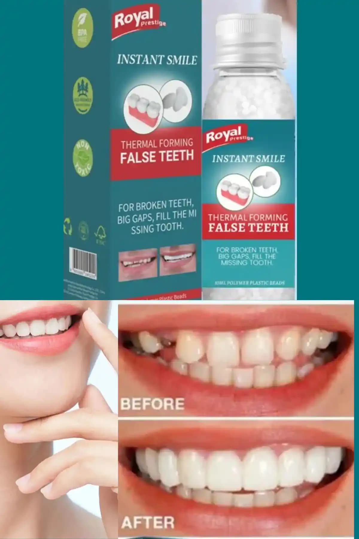 Uniquem Diş Yapma Seti: Acil Durumlar İçin Güvenilir Geçici Diş Onarımı Çözümü