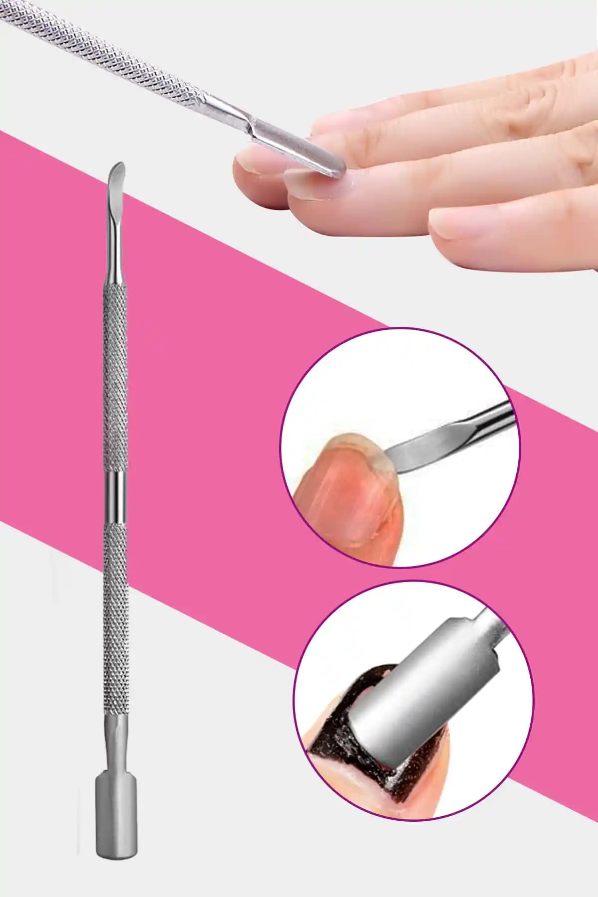 Xolo Kronk Tırnak Batık Çıkarıcı Paslanmaz Çelik Uzun Ömürlü ve Hijyenik Kullanım