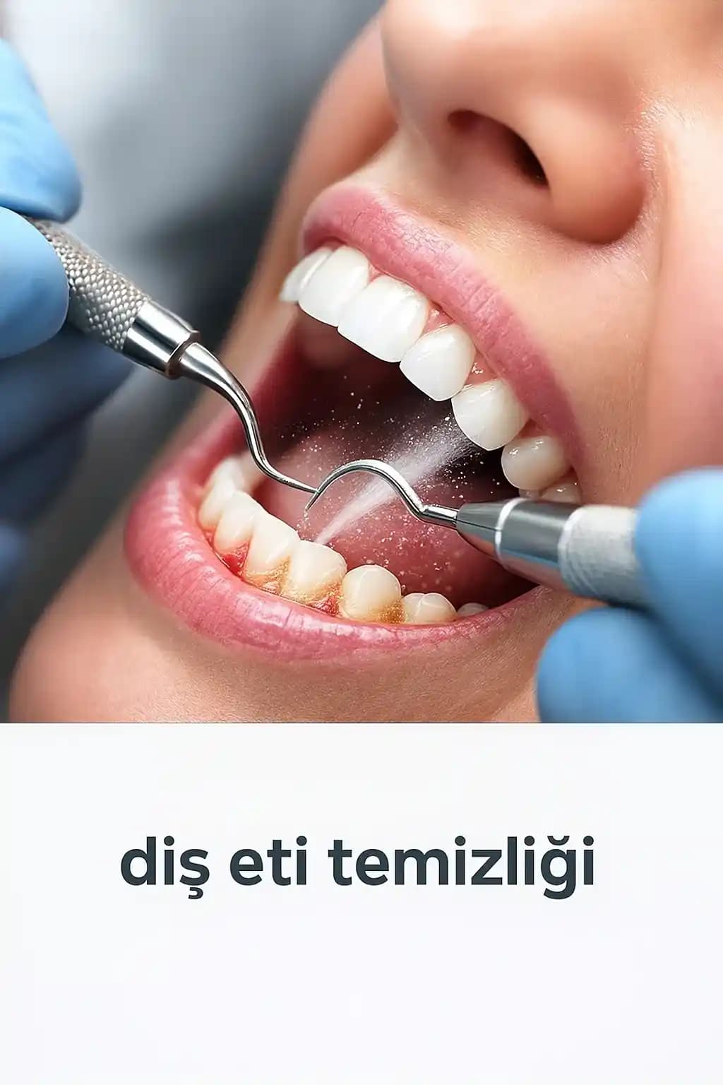 Ağız Sağlığını Koruma ve Diş Arası Temizliğinde Doğru Ürün Seçimi ve Uygulama Yöntemleri