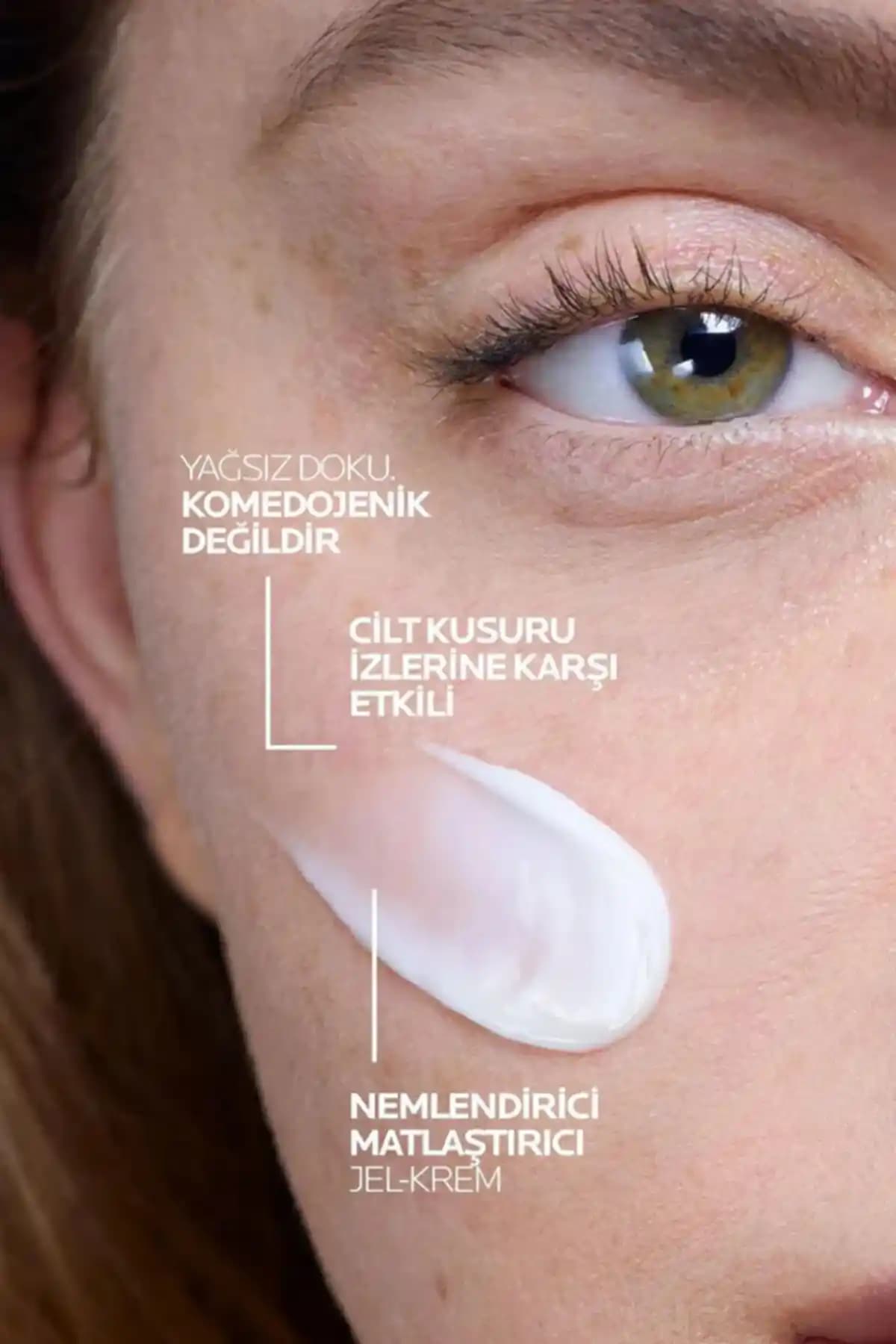 Akne Eğilimli Ciltler İçin Etkili Bakım Yöntemleri ve Doğru Ürün Seçimi Rehberi