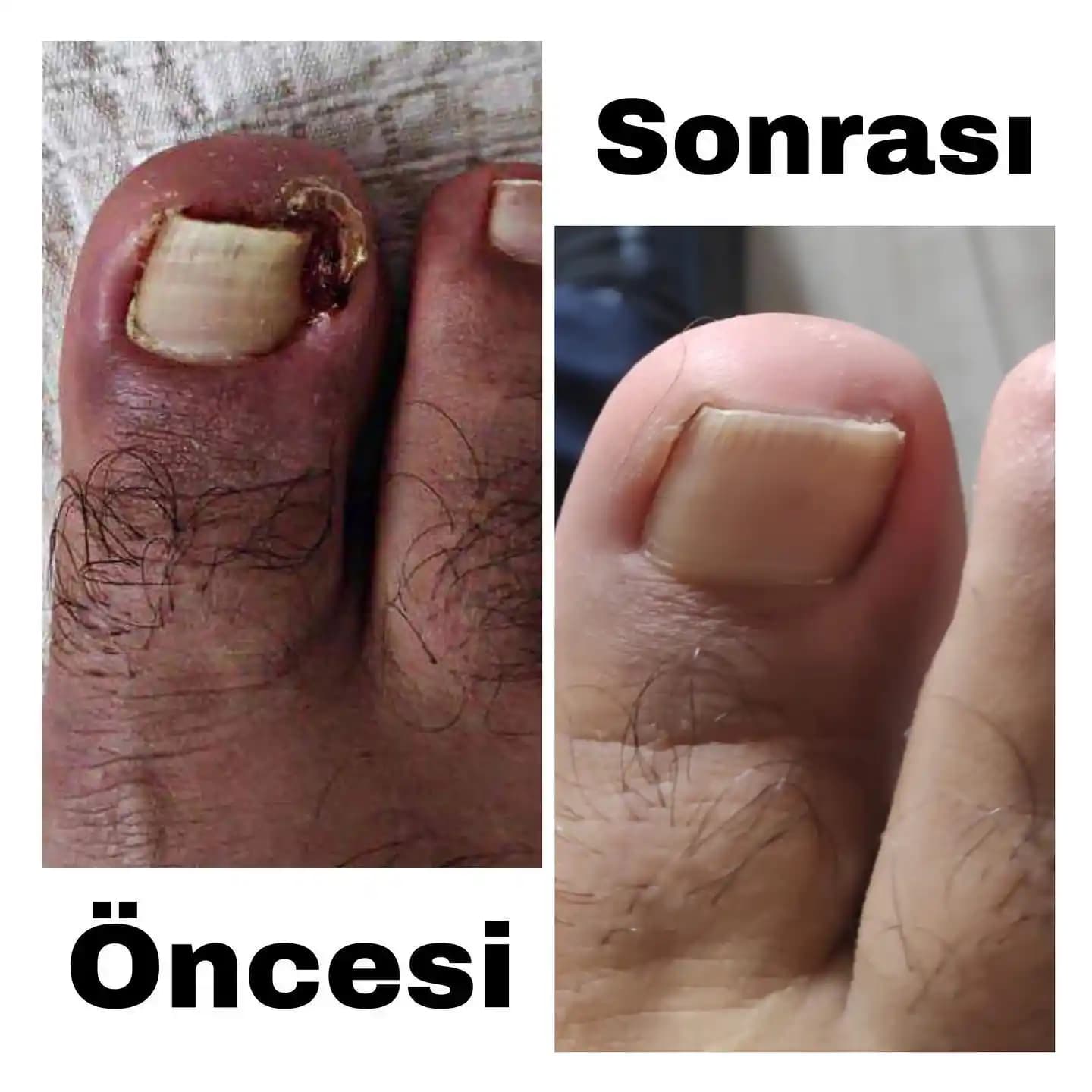 Ayak Sağlığı ve Pedikür Rehberi: Temel Bakım İpuçları ve Uygulama Yöntemleri