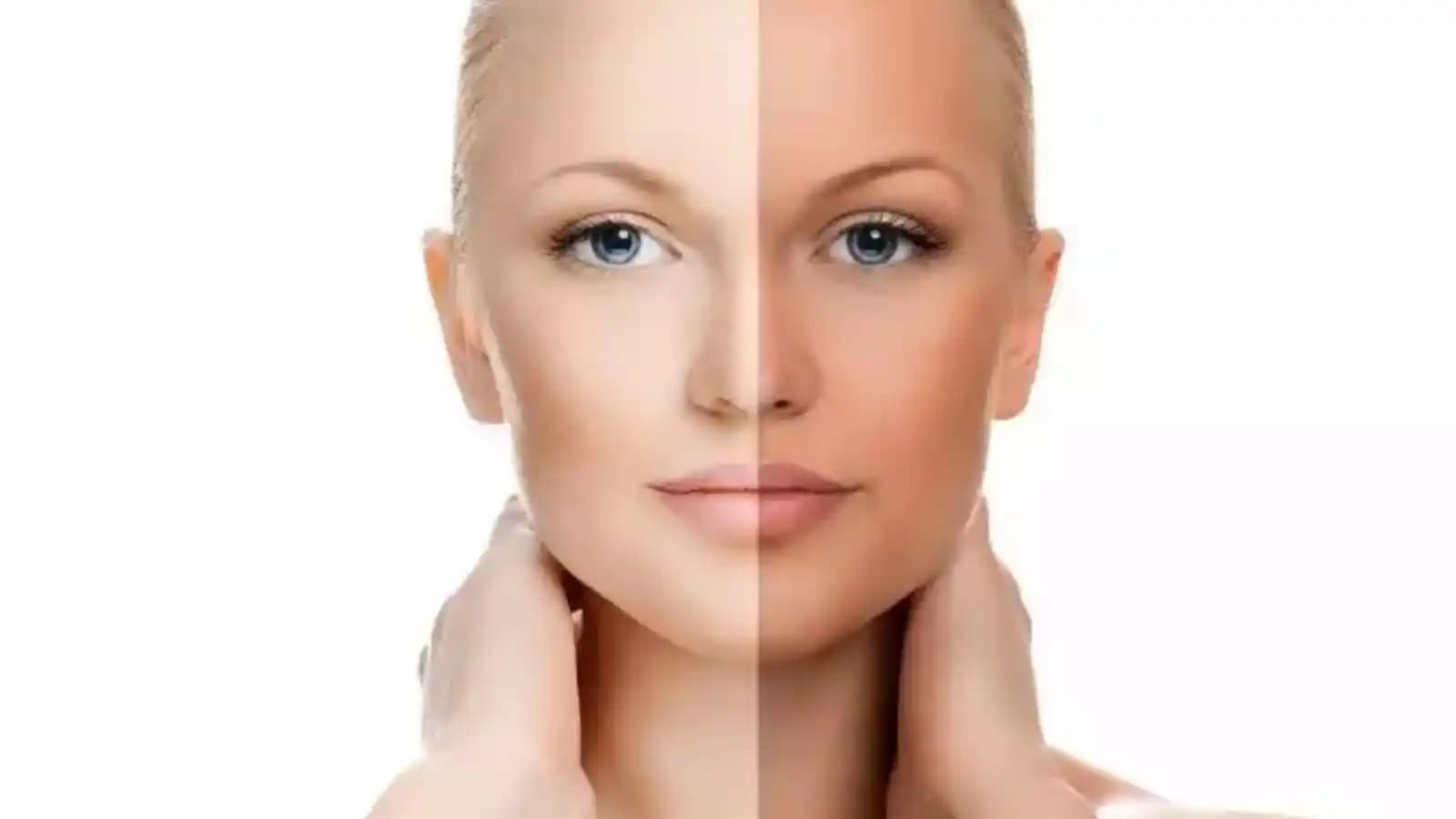 Bronzlaşma Sonrası Cilt Bakımı: Doğru Uygulamalar ve Öneriler