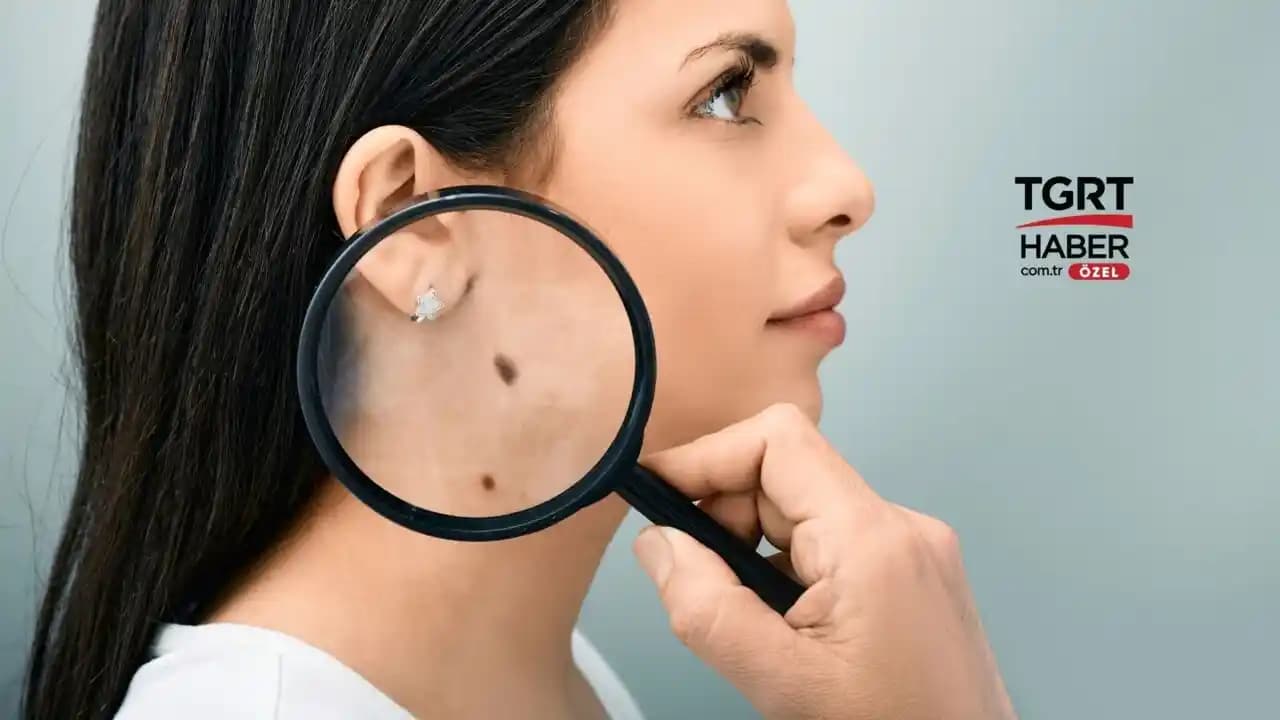 Cilt Kasılması ve En Etkili Tedavi Yöntemleri Hakkında Kapsamlı Bilgi