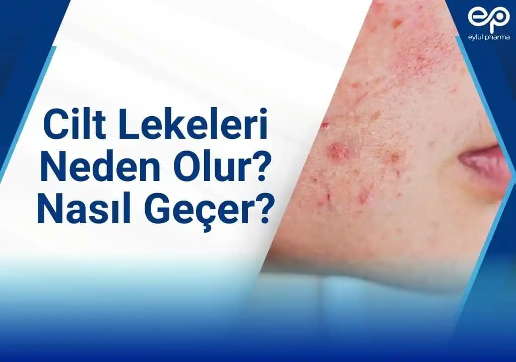 Cilt Lekelerini Azaltma ve Eşit Ton Sağlama Yöntemleri Rehberi