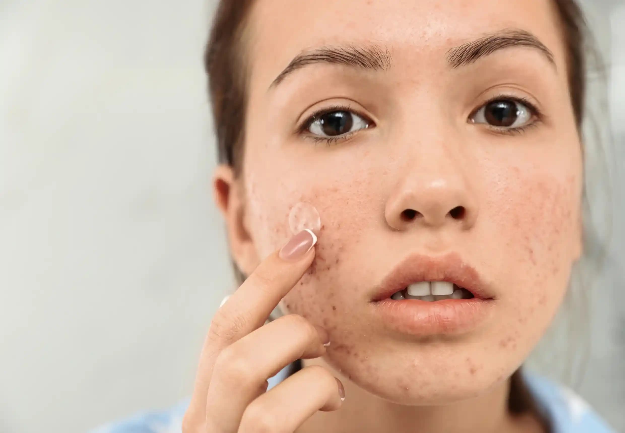 Cilt Sağlığını Korumanın Temel Yolları ve Doğru Bakım İpuçları