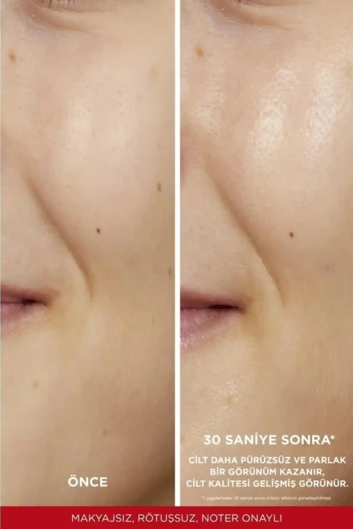 Cilt Yenileme ve Peeling Yöntemleri: Güncel Yaklaşımlar ve Güvenli Uygulamalar