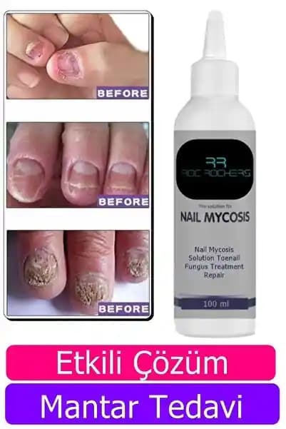 Güvenilir Tırnak Bakım Çözümleri ve Sağlıklı Tırnaklar İçin Bilmeniz Gerekenler