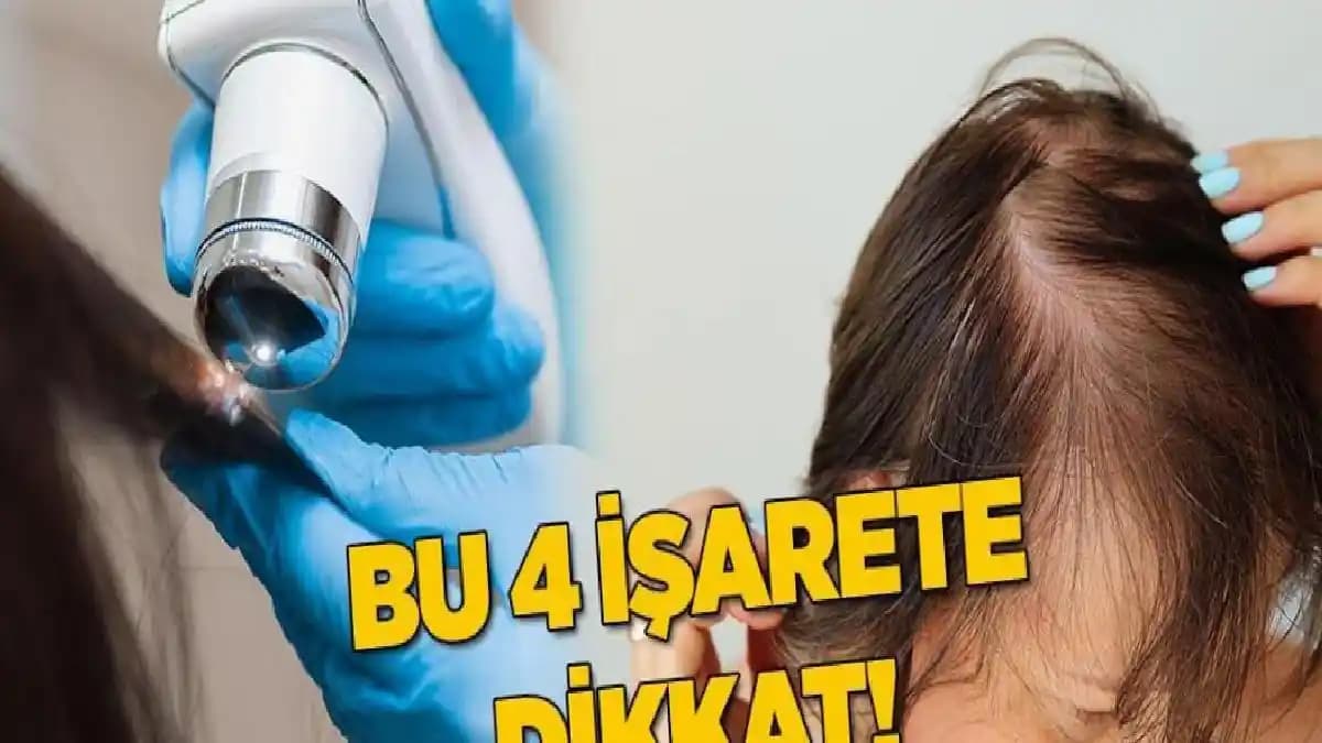 Saç Dökülmesine Karşı Güçlü ve Güvenilir Çözüm Yöntemleri ve Ürünler