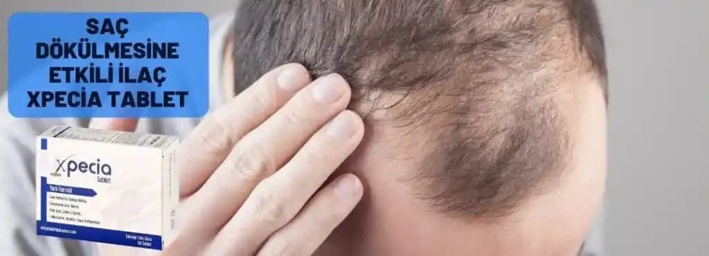 Saç Dökülmesine Karşı Güncel İlaçlar ve Etkili Tedavi Yöntemleri