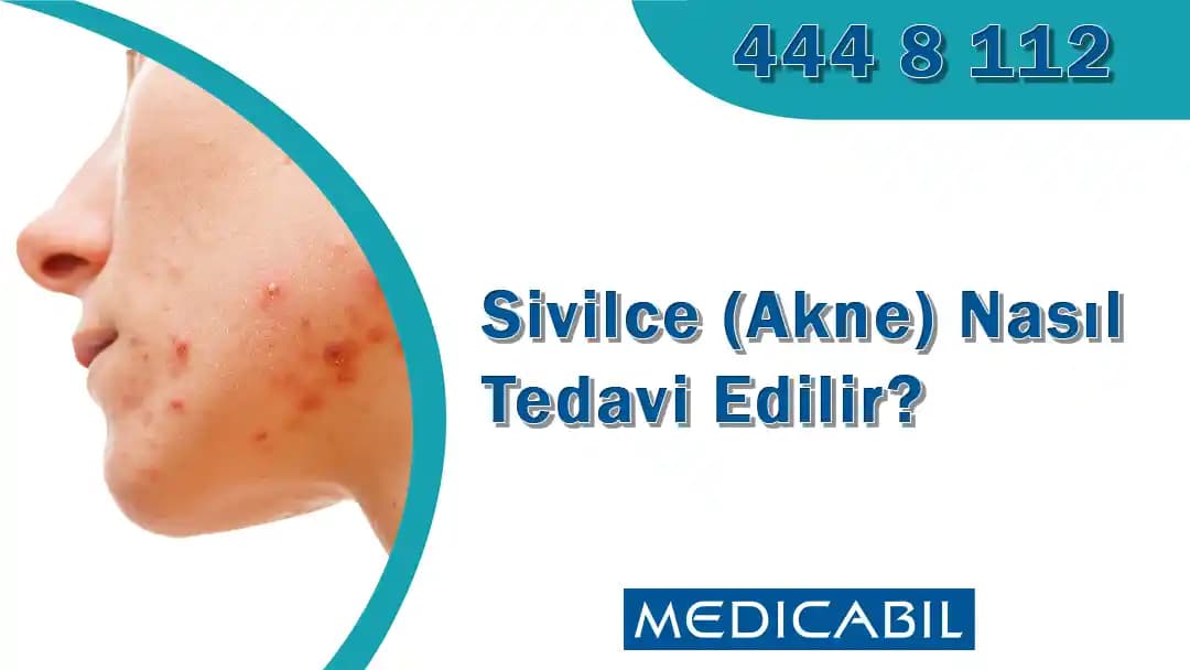 Çene Bölgesinde Sivilce Tedavi ve Önleme Yöntemleri Hakkında Kapsamlı Rehber