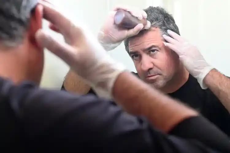 Erkekler İçin Saç Boyama Rehberi: Renk Seçimi ve Bakım İpuçlarıyla Güzel Sonuçlar