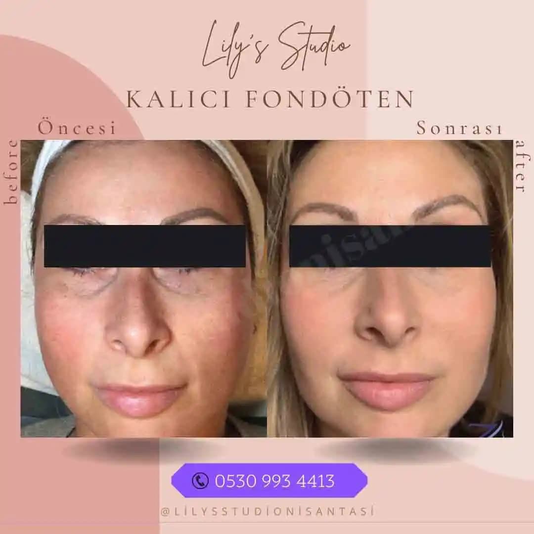 Kalıcı Fondöten ve Rosto Makyajında Uygulama Yöntemleri ve Ürün Önerileri