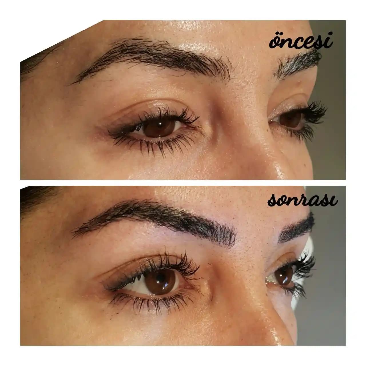 Kalıcı Kontur İşlemlerinin Süreleri ve Etkileyen Faktörler Hakkında Detaylı Bilgi