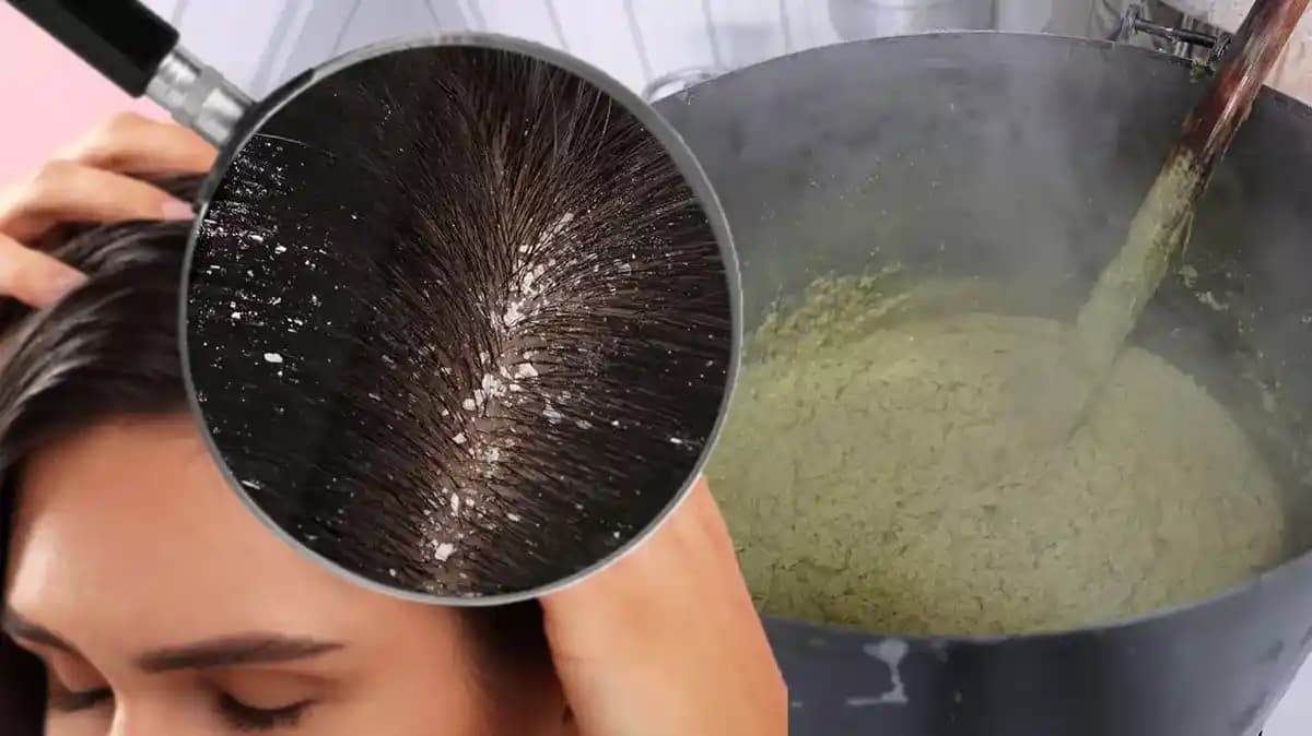 Kepeği Önleyen ve Saç Dökülmesini Engelleyen Etkili Yöntemler