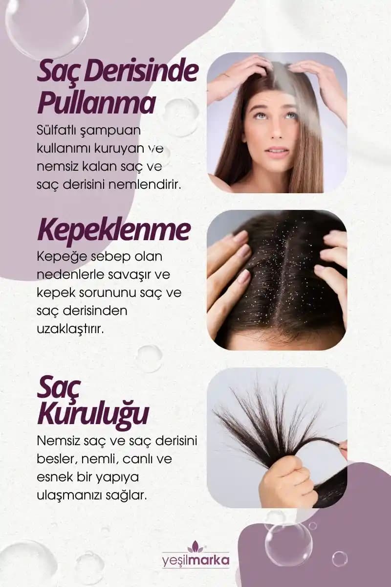 Kepekli Saçlar İçin Doğal Şampuanlar: Saç Sağlığını Koruyan Bitkisel Çözümler