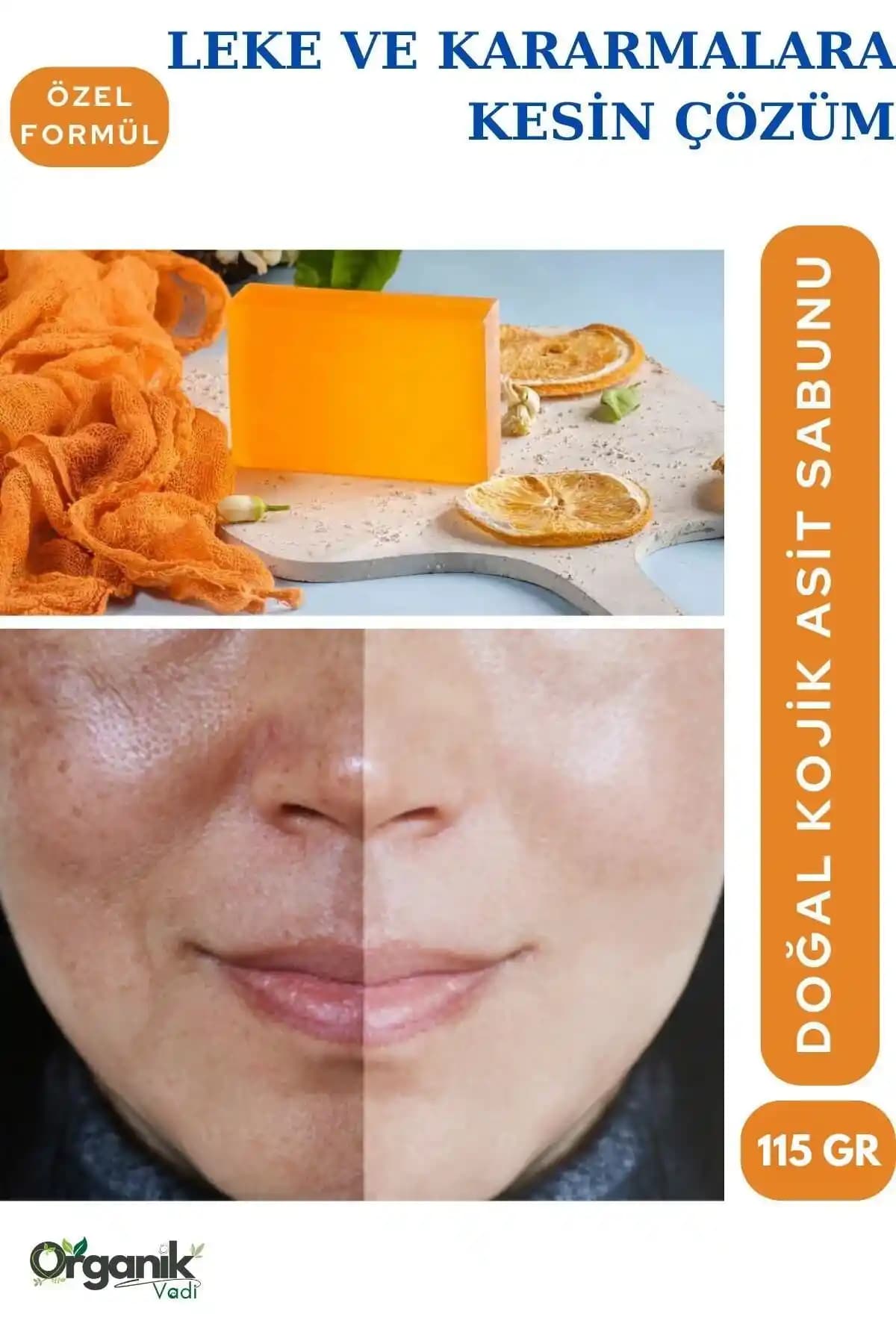 Kojic Asit Sabunu ve Cilt Lekeleri Üzerindeki Etkileri Hakkında Bilgilendirici Rehber