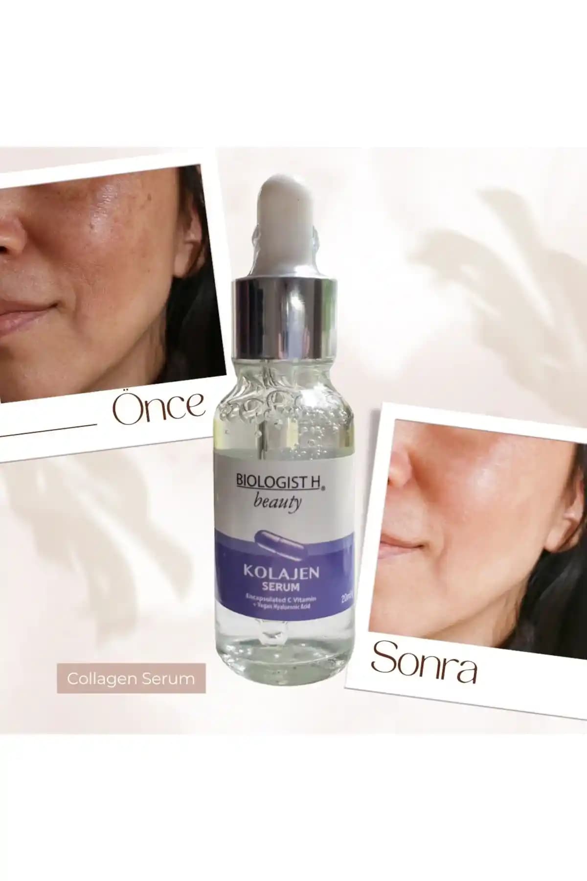 Kolajen ve Cilt Sağlığı: Güzellik ve Yaşlanma Karşıtı Etkileri Hakkında Bilgi