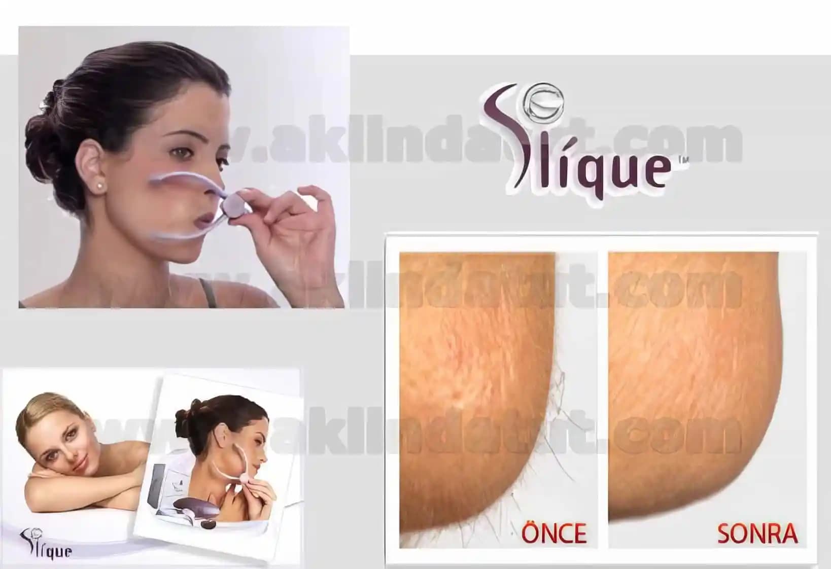 Nazik Tüy Alma Sünger Yöntemi: Hassas Ciltler İçin Etkili ve Güvenli Çözüm