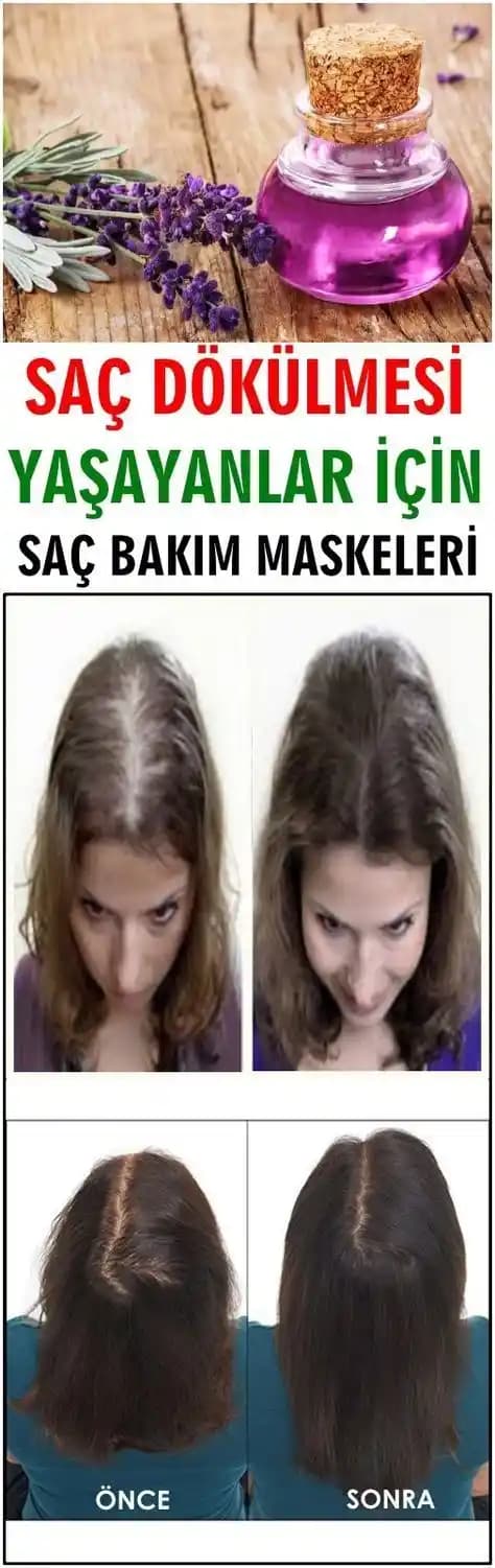 Saç Dökülmesine Karşı Doğal ve Etkili Maskeler Hakkında Bilmeniz Gerekenler