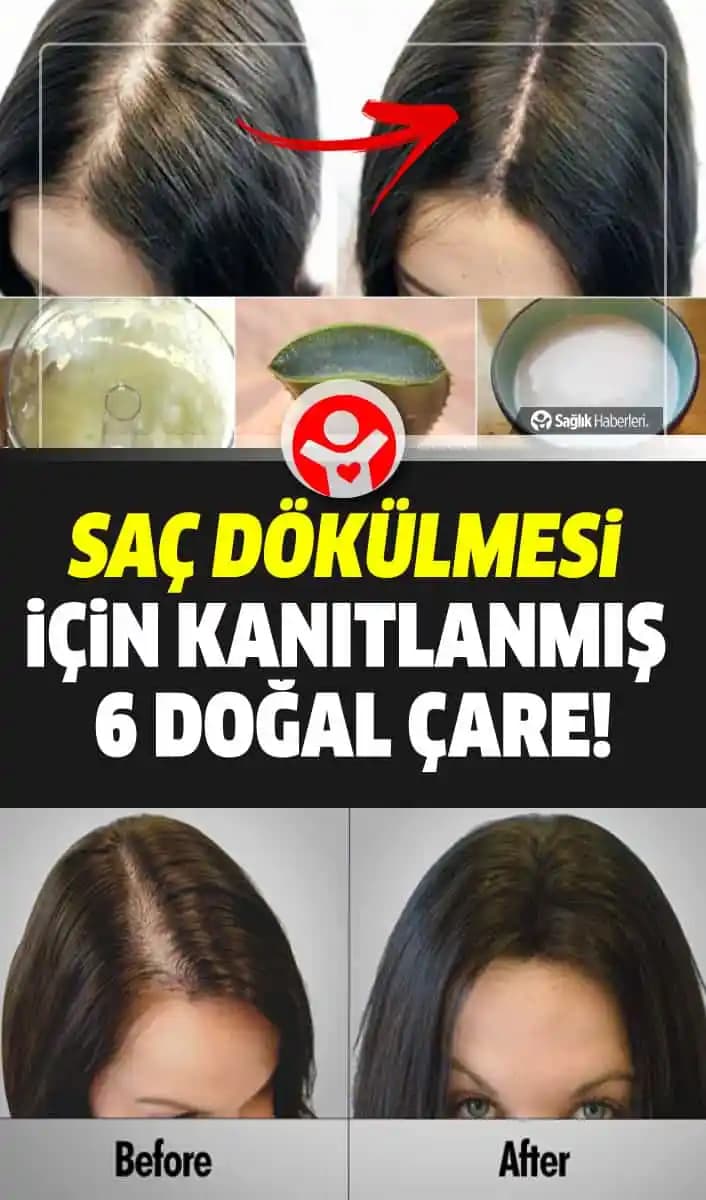 Saç Dökülmesine Karşı Doğal Yağlar ve Saç Sağlığını Destekleme Yöntemleri
