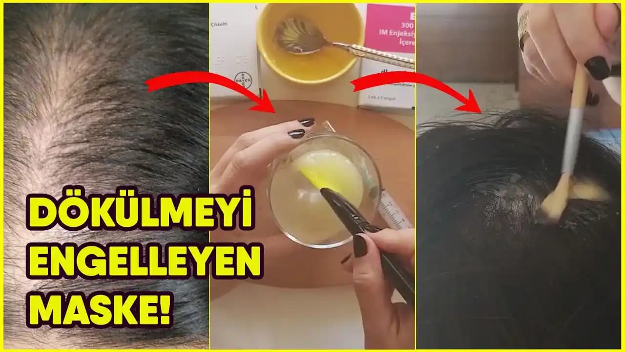 Saç Dökülmesini Engelleyen Doğal Maskeler ve Uygulama Yöntemleri Hakkında Bilgi