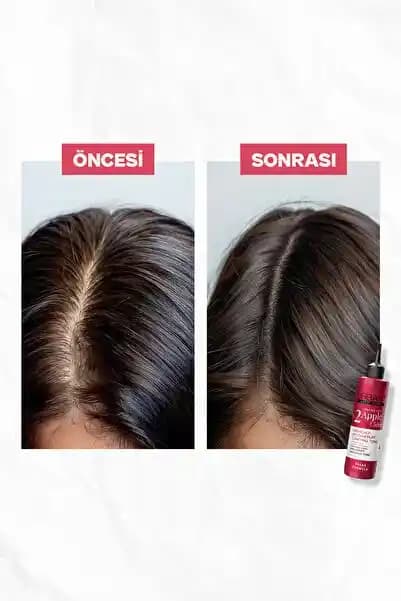 Saç Yağlanmasını Kontrol Altına Almanın Etkili ve Güvenilir Yöntemleri