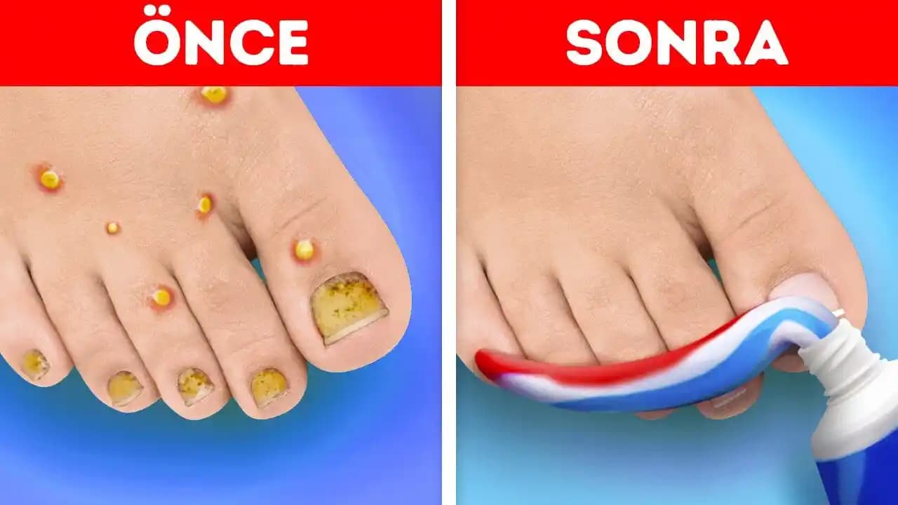 Sağlıklı Ayak Bakımı ve Pedikür İpuçlarıyla Ayaklarınızı Koruyun