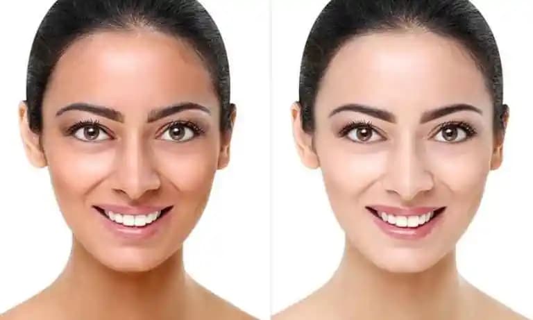 Ten Rengini Açma Yöntemleri: Güvenilir ve Etkili Yaklaşımlar Hakkında Detaylı Rehber