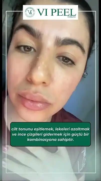 Yeni Dönem Cilt Yenileme Tonikleri: Cilt Sağlığını Destekleyen Modern Formüller