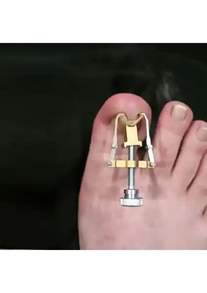 Batık Tırnak Düzeltme Aletleri Karşılaştırması: Loves Shopping ve GoodSell Ürünleri Analizi