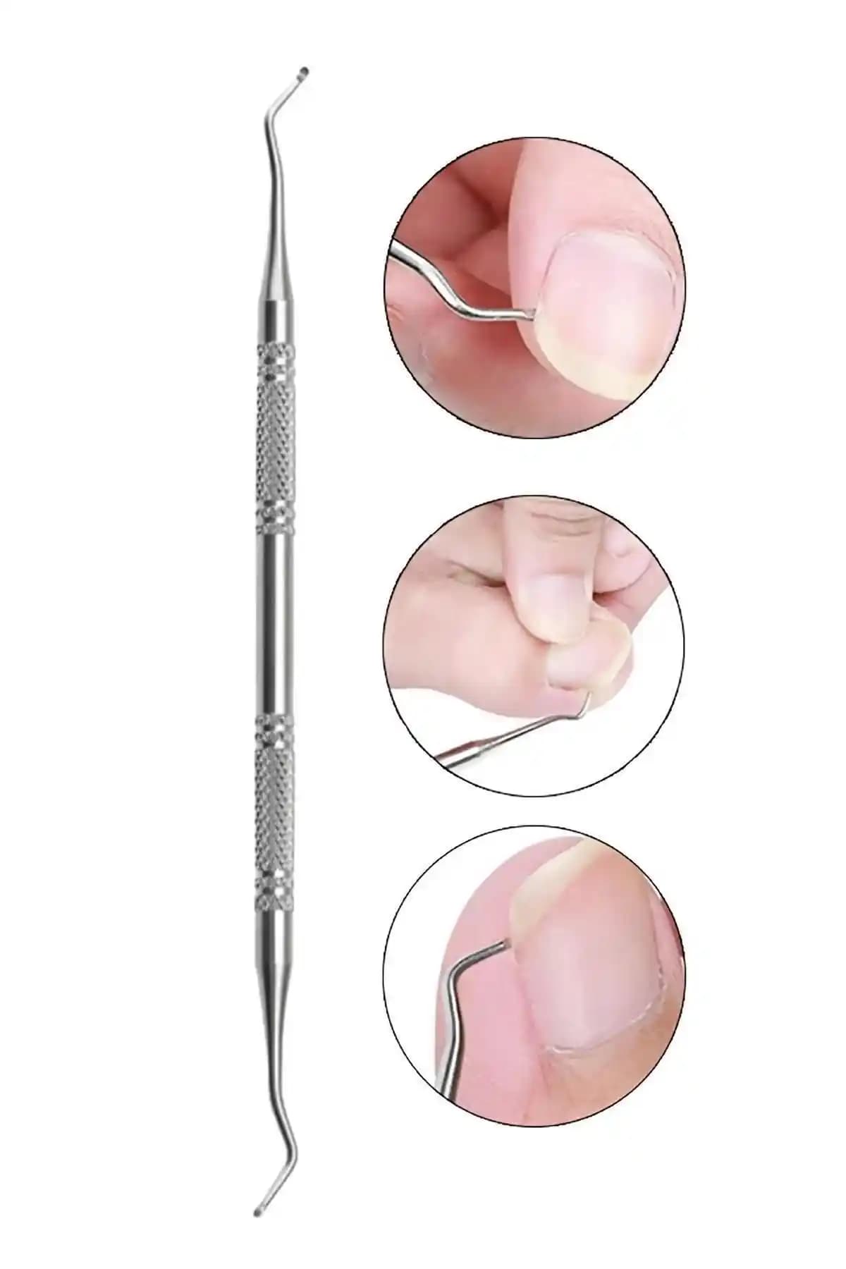 MOZIUR Küret Tırnak Batık Çıkarıcı: Etkili ve Güvenilir Tırnak Sağlığı Aracı