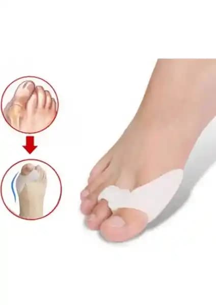 AriaTech Baş Parmak Bunyon Silikonu: Ayak Sağlığını Koruyan Medikal Destek Çözümü