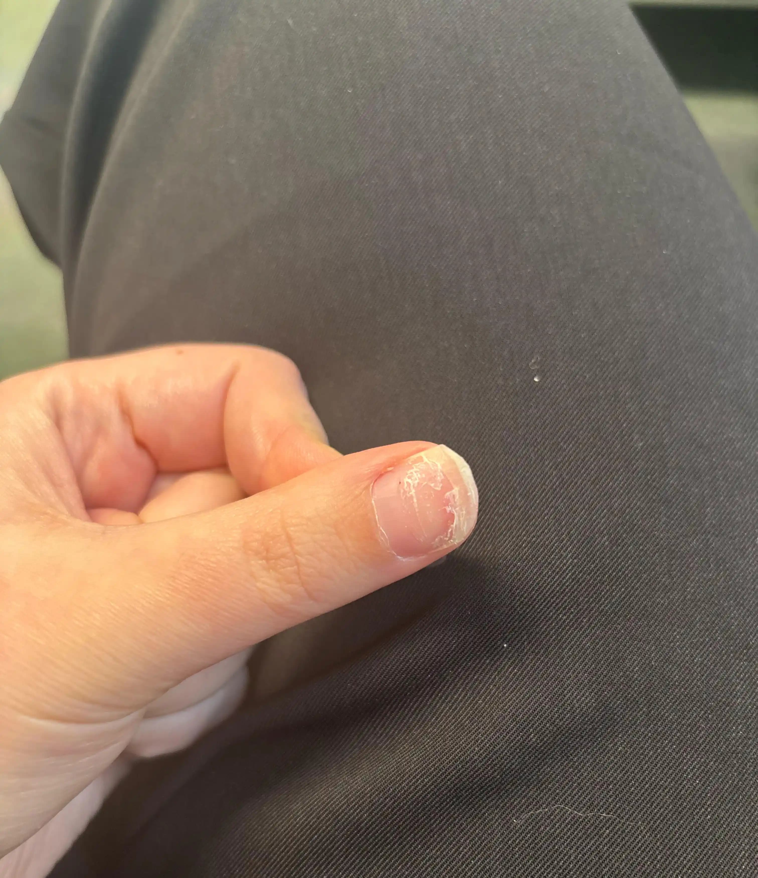 Jel Tırnak Sonrası Tırnak Hasarını Onarma ve Bakım Yöntemleri