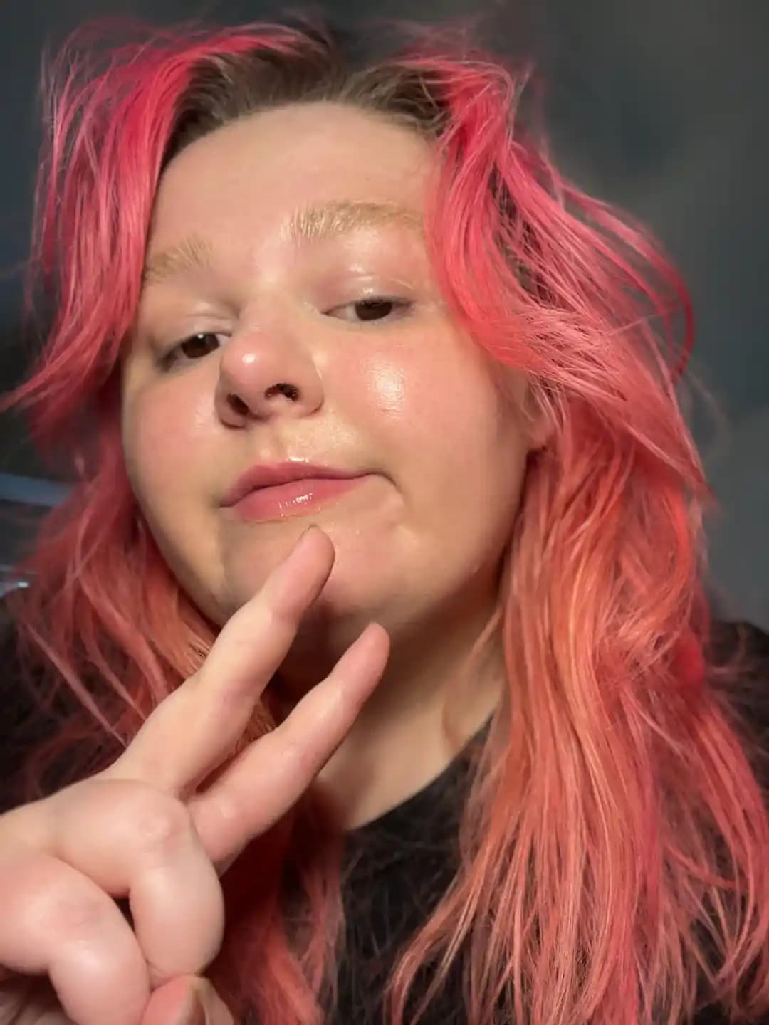 Problemli Ciltler İçin Etkili Bakım Rutinleri ve Dermatolojik Yaklaşımlar