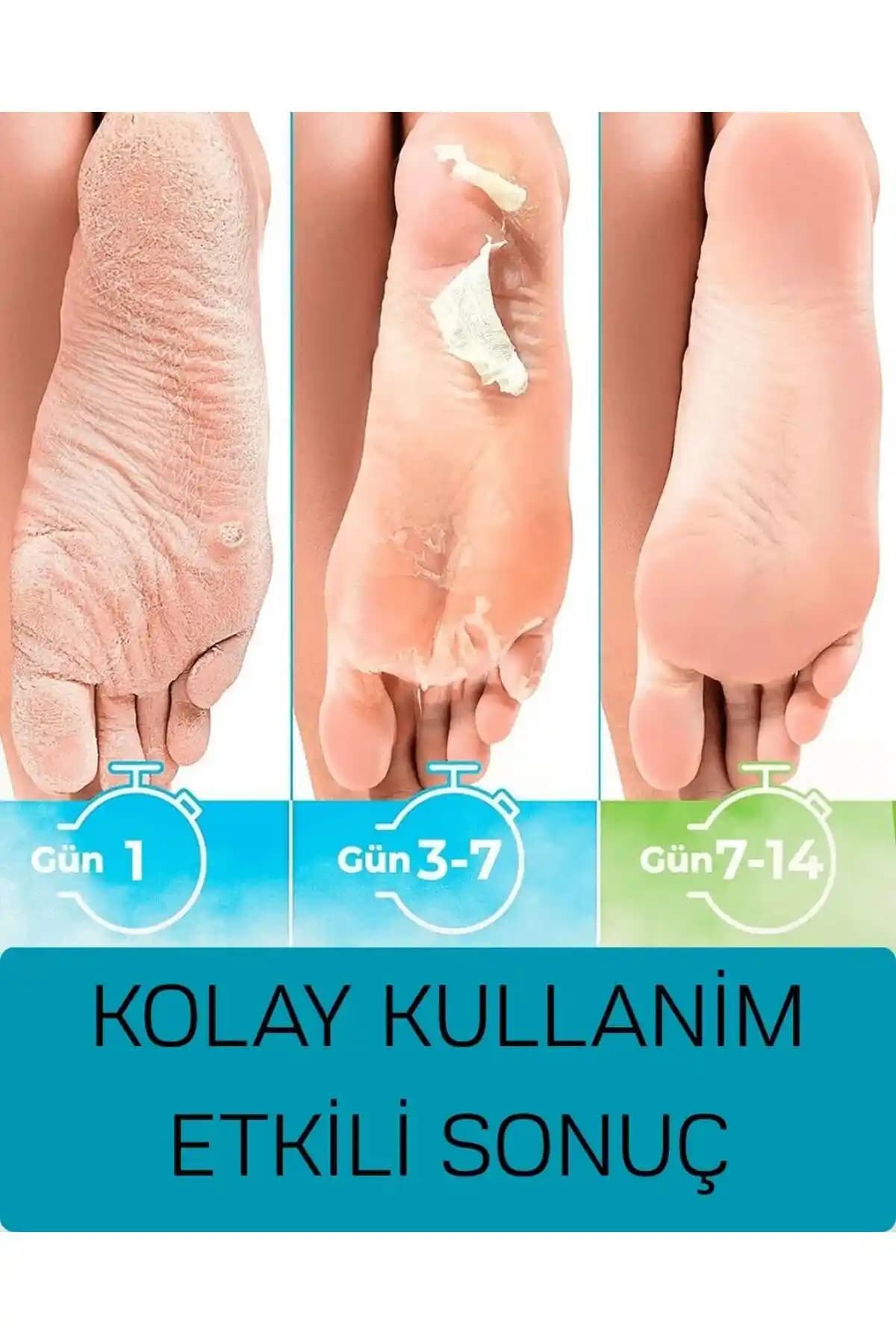 BİO SHOES Ayak Soyucu Peeling Maskesi: Derinlemesine Ayak Bakımı ve Kullanım Rehberi