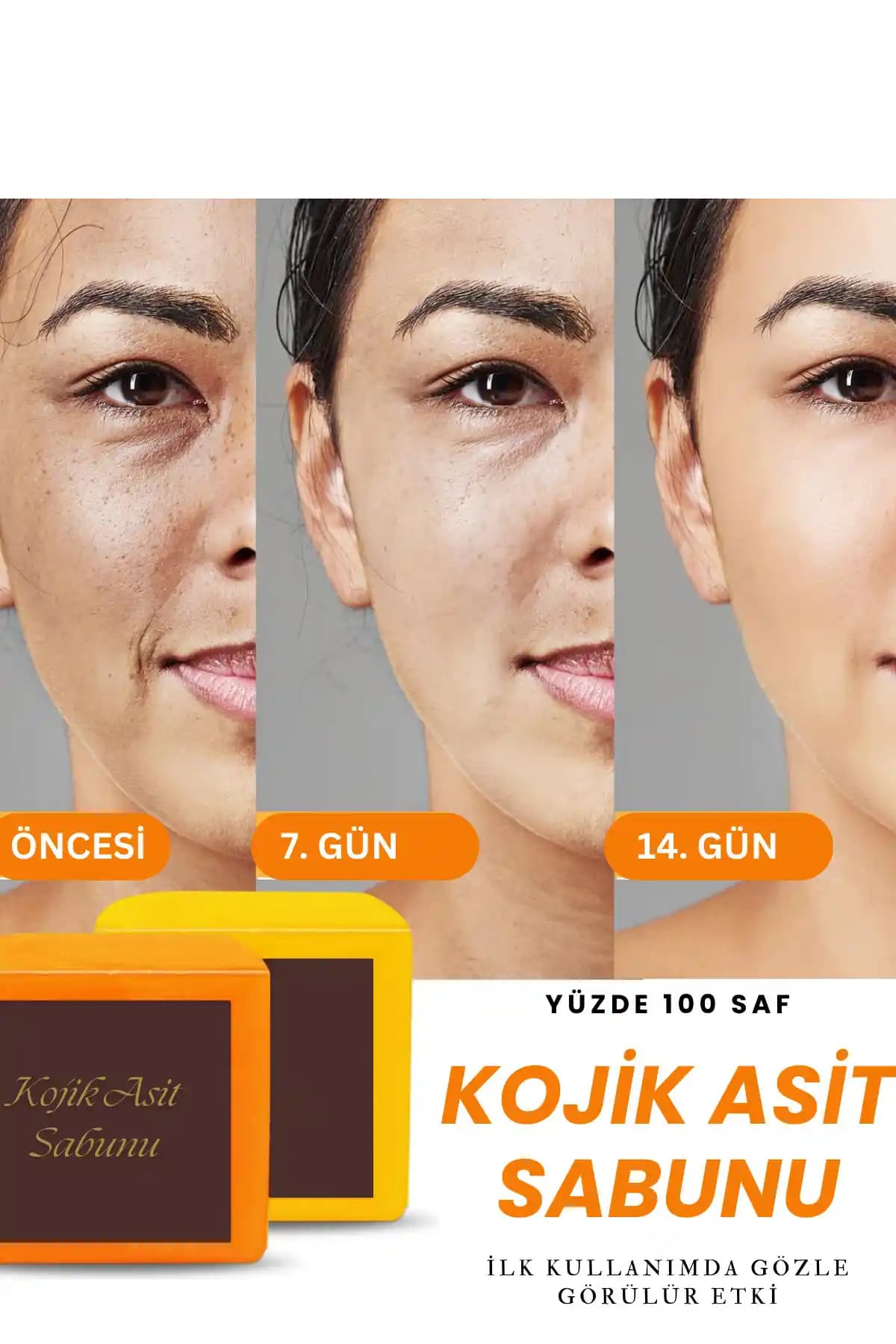 VERANT Kojik Asit Sabunu: Leke Karşıtı ve Cilt Aynlaştırıcı Doğal Bakım Ürünü